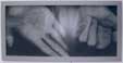 Christian Boltanski, Maladie, 2002, foto incorniciata, 13?????U`0 x 100 cm